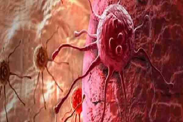1555735607 cancer 1