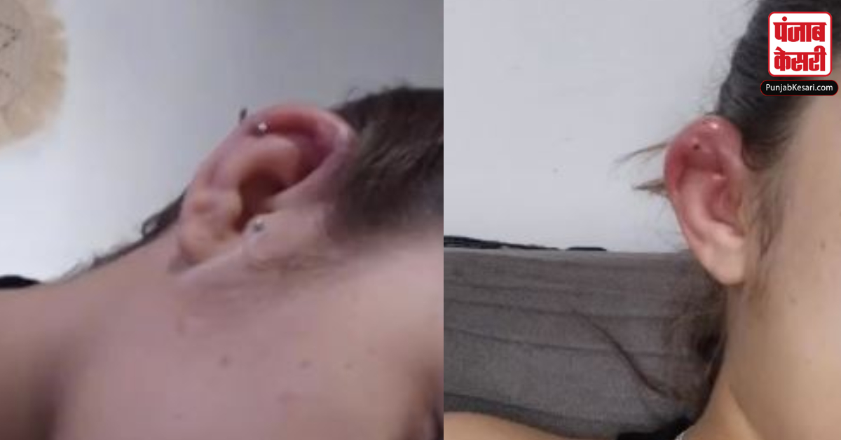 Piercing side effects