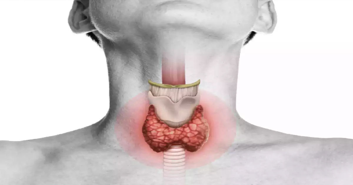 Thyroid Problems