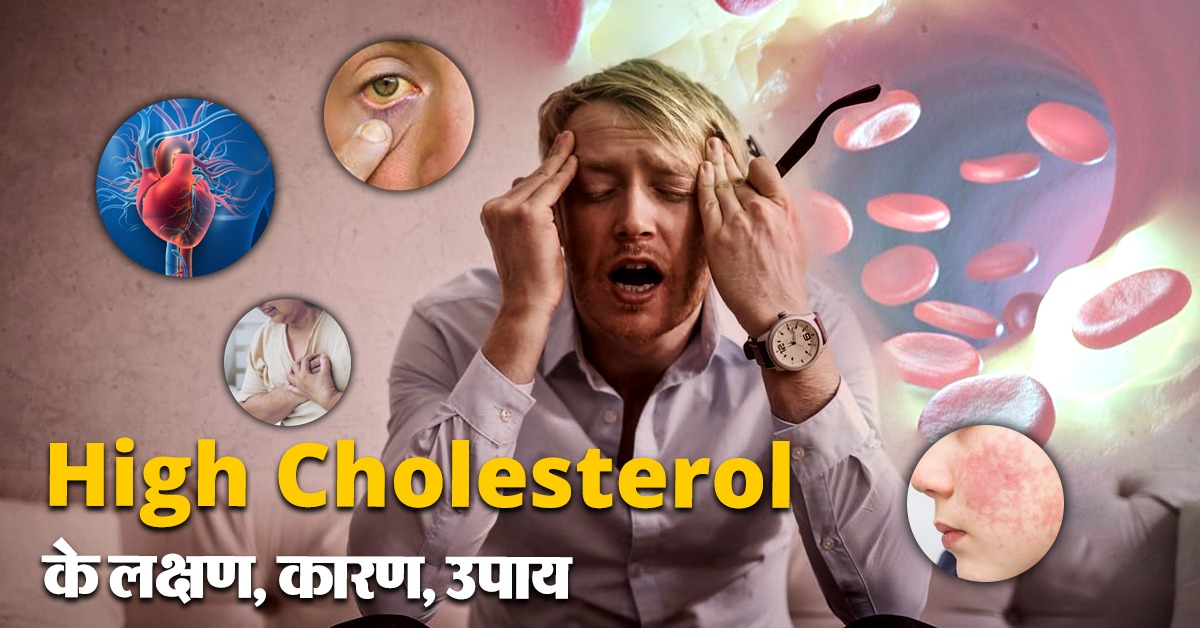 High Cholesterol