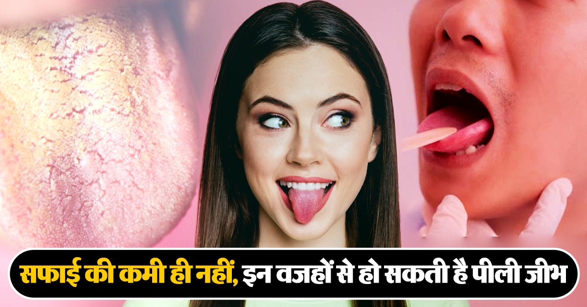 Yellow Tongue Causes