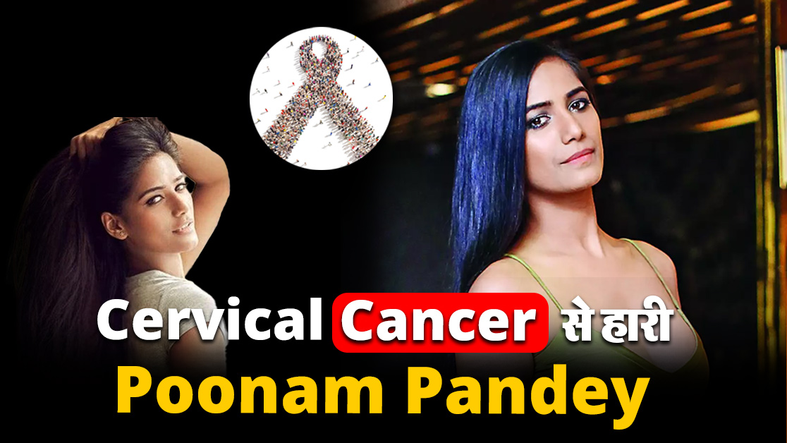 Cervical Cancer