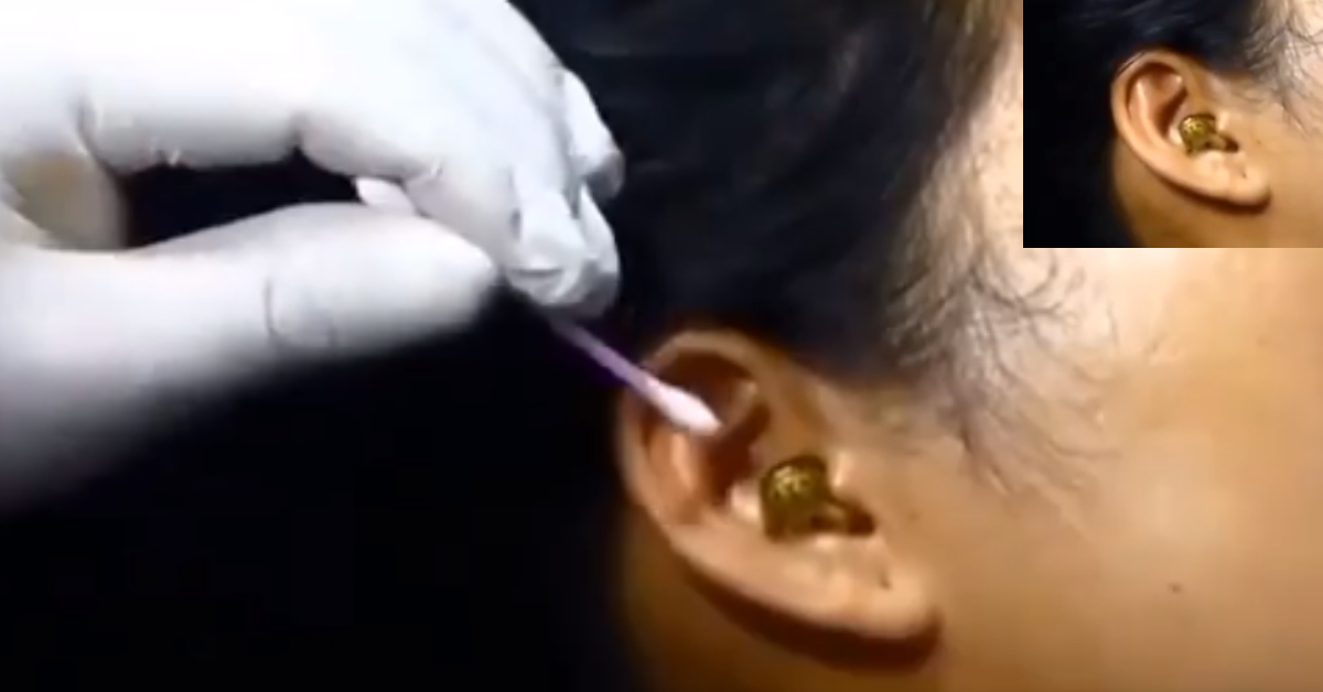 Snake Woman Ear Viral