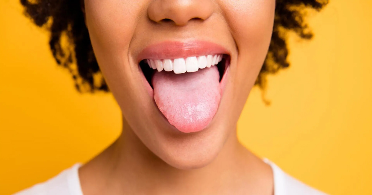 Mouth Cancer