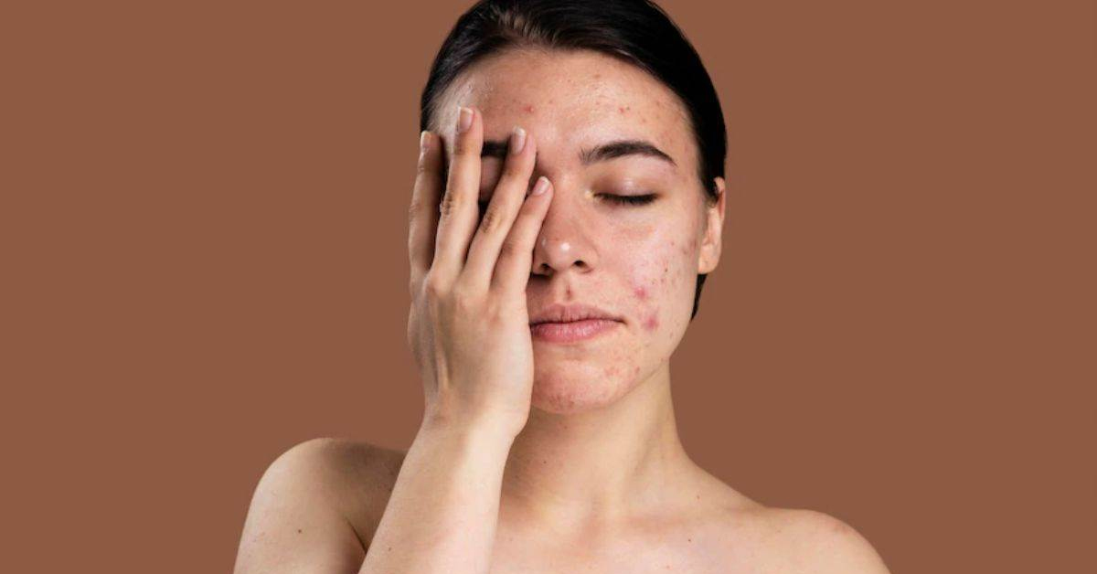 Summer Skin Care