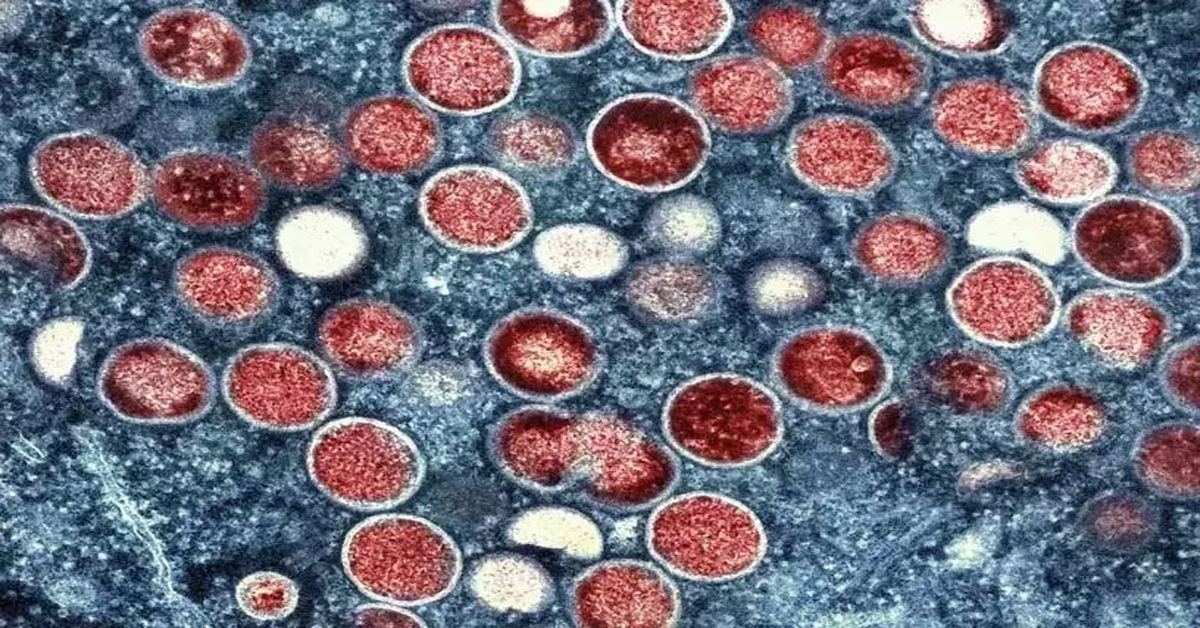 Ampox Virus