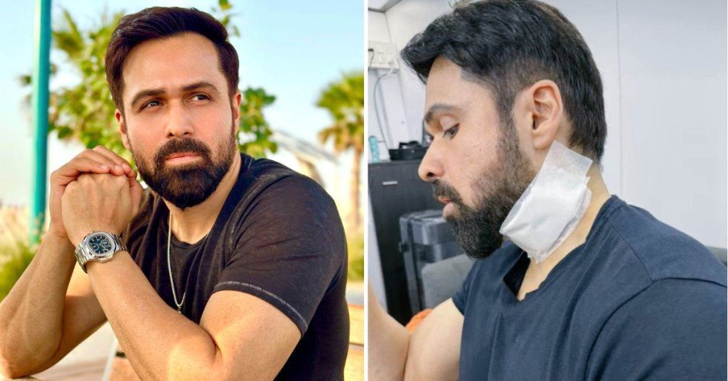 07 10 2024 emraan hashmi injured 23811755 e1728358196967