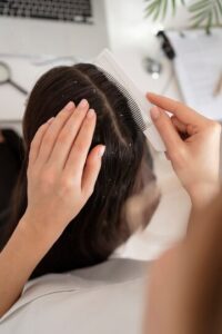 सर्दियों में इस तरह पाएं Dandruff से निजात