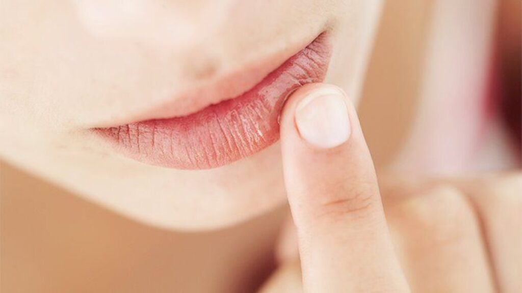 1368232 lipsdryness 1733236189