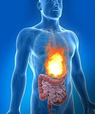 1387301 Natural Ways To Prevent Acidity And Heartburn