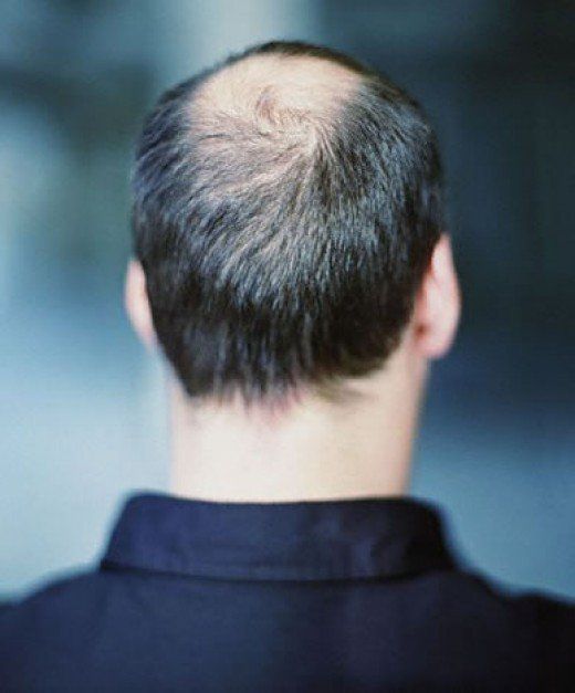 1389642 Natural Ways of Preventing Hair Loss and Growing Thicker Hair
