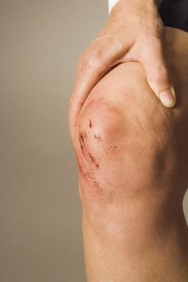 1402106 injury