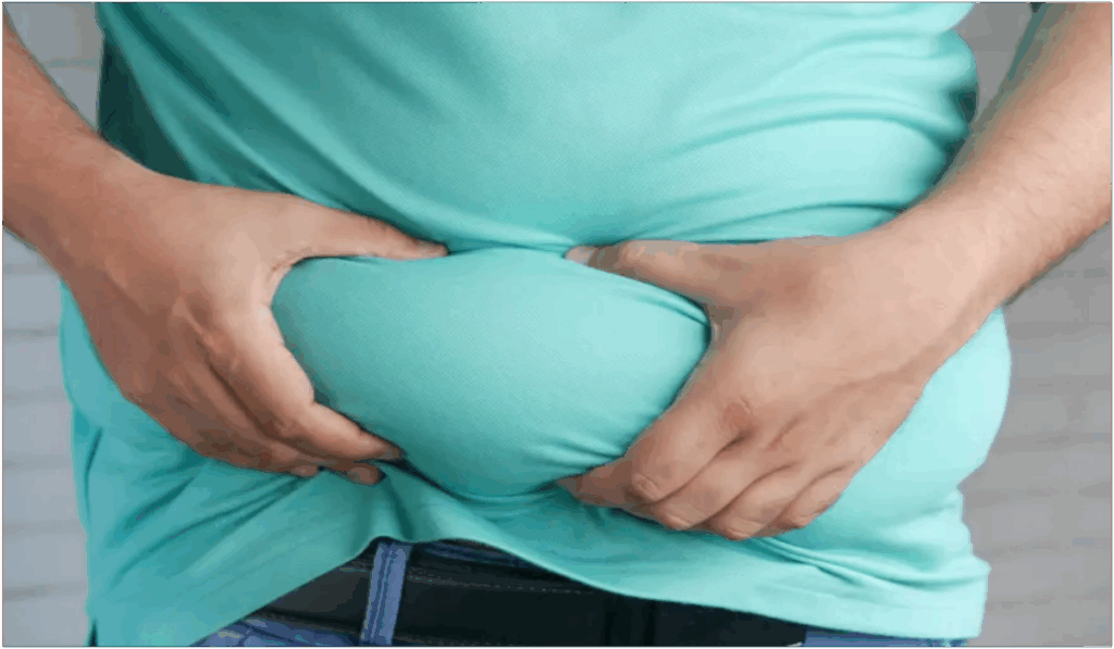 1443931 Obesity