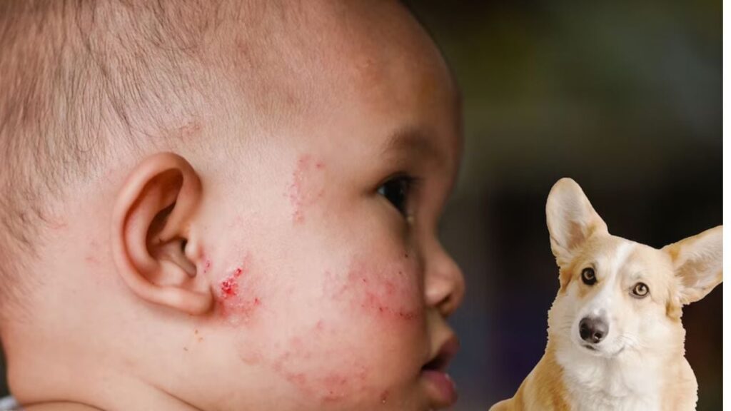 1447172 eczema
