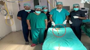 ‘खा जाती थी चाक, धागा…’, डॉक्टरों ने 14 साली की बच्ची के पेट से निकाली दुनिया की सबसे बड़ी गांठ
