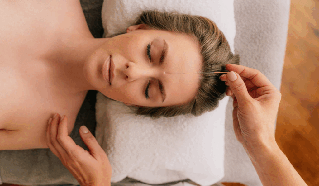1450190 Facial Acupuncture